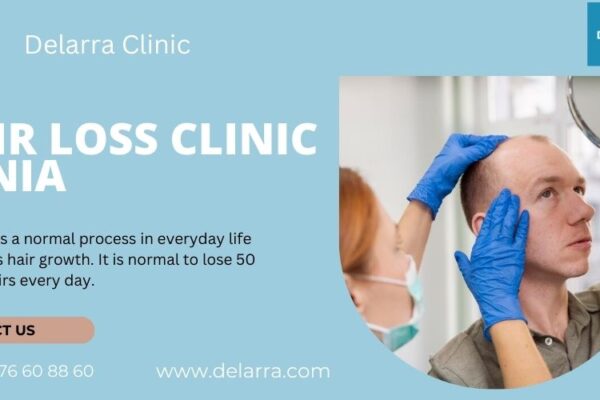 hair loss clinic Denia