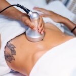 Coolsculpting in Houston